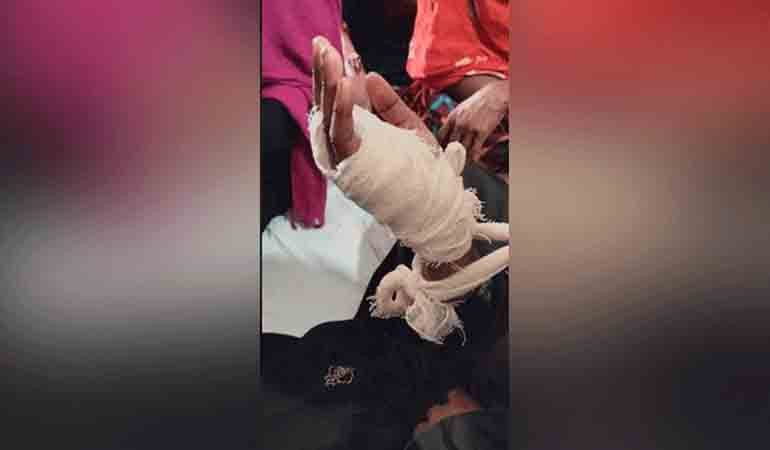 যুবকের অস্ত্রের আঘাতে কলেজছাত্রী আহত