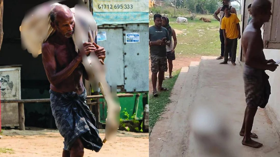 টাকা তুলতে ব্যাংক চাইল মৃত্যুর প্রমাণ, বোনের কঙ্কাল কাঁধে হাজির ভাই