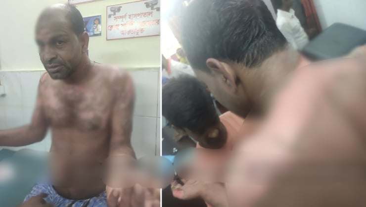 জামালপুরে ঘুমন্ত স্বামীর ওপর গরম পানি ঢেলে স্ত্রীর হত্যা চেষ্টা