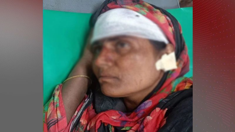 দাঁড়িপাল্লার প্রচারে বাধা, নারীর কান ছিঁড়ে মাথা ফাটালেন যুবদল নেতা