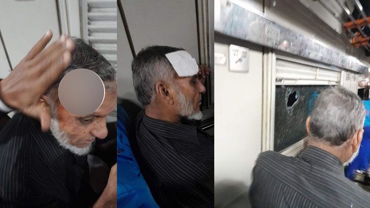 চলন্ত ট্রেনে নিক্ষেপ করা পাথরে ফাটল বৃদ্ধের মাথা