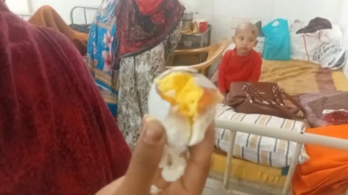 হাসপাতালে রোগীদের নাস্তার ডিমে মিলল বাচ্চা!