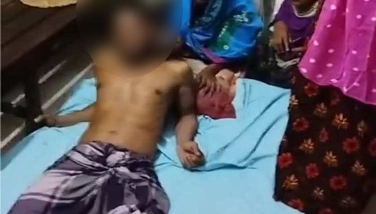দেবরের 'পুরুষাঙ্গ'কেটে দিলো ভাবি