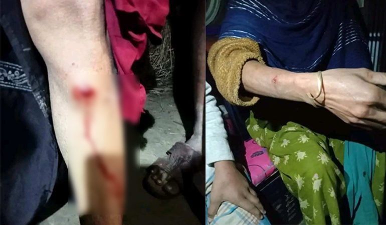 অচেনা প্রাণীর আক্রমণে আহত ১২, আতঙ্কে এলাকাবাসী