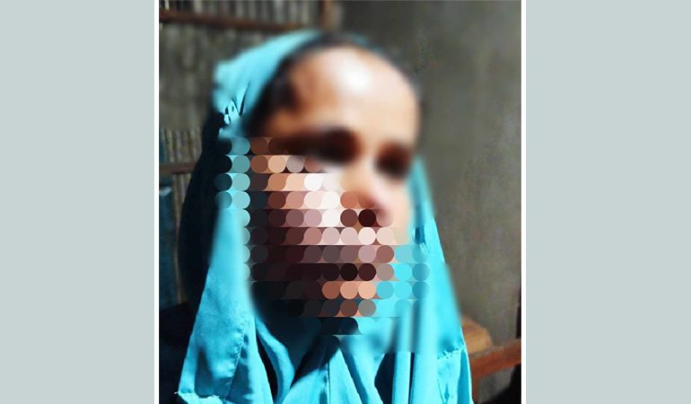 স্বামীর সাথে পরকীয়া সন্দেহে প্রতিবেশীকে আগুনের ছ্যাকায় ঝলছে দিলো নারী