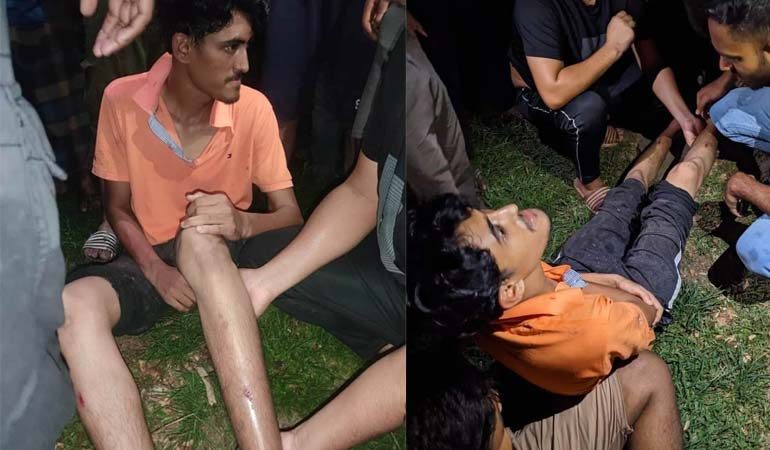 মাদক সেবন দেখে ফেলায় বেরোবি শিক্ষার্থীকে মারধর, আহত ২