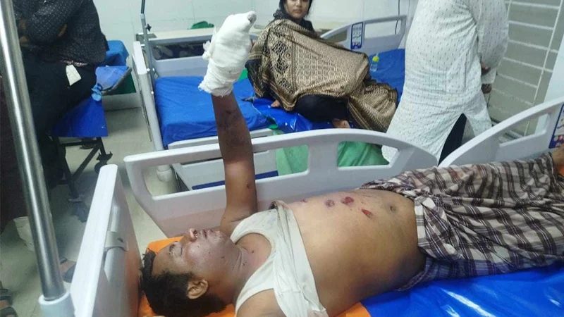 বাসার ছাদে ককটেল নিয়ে খেলছিল শিশু, কেয়ারটেকার হাতে নিতেই বিস্ফোরণ