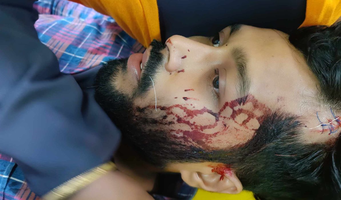 কিশোরগঞ্জে সাংবাদিককে পিটিয়ে হত্যার চেষ্টা