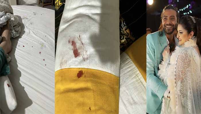 হাতে ব্যান্ডেজ, বিছানায় রক্তের দাগ, কী হয়েছে পরীমনির?