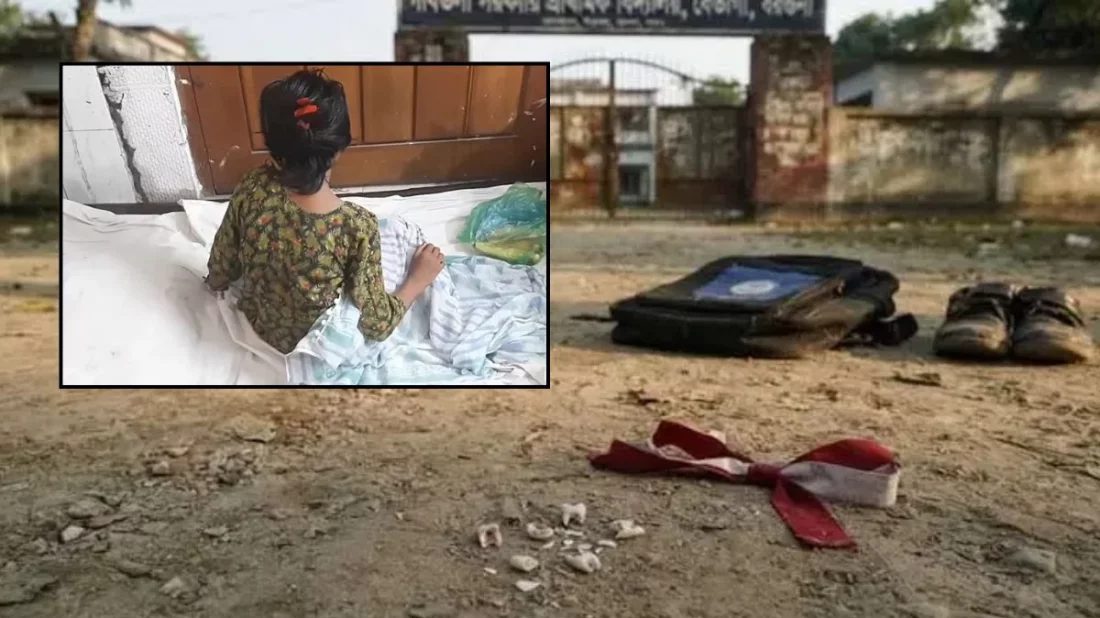 বখাটের চড়–লাথিতে দাঁত ভেঙে গেল পঞ্চম শ্রেণির ছাত্রীর
